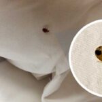 Top Bed Bug Treatment Companies -How to Choose the Best for Your Home